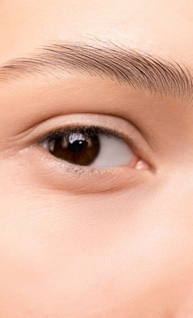 نتيجة زراعة الحواجب قبل وبعد في عيادة Healthy Beauty Clinic لبنان - حواجب كثيفة وطبيعية